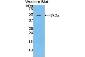 Western Blotting (WB) image for anti-Myosin, Light Chain 6B, Alkali, Smooth Muscle and Non-Muscle (MYL6B) (AA 6-137) antibody (ABIN1859943) (MYL6B 抗体  (AA 6-137))