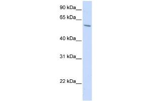 PORCN antibody used at 1 ug/ml to detect target protein. (PORCN 抗体)