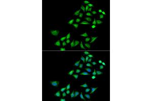 Immunofluorescence analysis of A549 cells using KLK4 antibody (ABIN5973996). (Kallikrein 4 抗体)