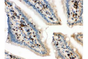 Anti- Cofilin Picoband antibody, IHC(P) IHC(P): Mouse Intestine Tissue (Cofilin 抗体  (C-Term))