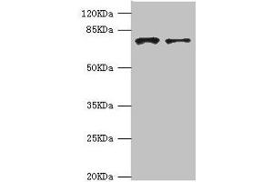 Western blot All lanes: GBE1 antibody at 3. (GBE1 抗体  (AA 1-300))