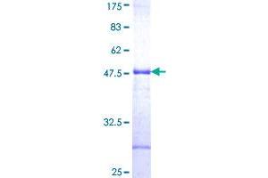 Image no. 1 for Aspartate beta-Hydroxylase (ASPH) (AA 161-270) protein (GST tag) (ABIN1345879)