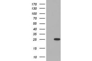 HEK293T cells were transfected with the pCMV6-ENTRY control (Left lane) or pCMV6-ENTRY MOBKL2B (Right lane) cDNA for 48 hrs and lysed. (MOBKL2B 抗体)