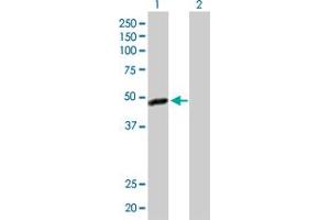 Western Blot analysis of C17orf75 expression in transfected 293T cell line by C17orf75 MaxPab polyclonal antibody. (C17orf75 抗体  (AA 1-396))