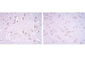 Immunohistochemical analysis of paraffin-embedded human brain tissues (left) and rat brain tissues (right) using GRIA3 mouse mAb with DAB staining. (Glutamate Receptor 3 抗体)