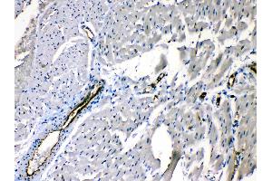 ANGPTL2 was detected in paraffin-embedded sections of rat cardiac muscle tissues using rabbit anti- ANGPTL2 Antigen Affinity purified polyclonal antibody (Catalog # ) at 1 µg/mL. (ANGPTL2 抗体  (Middle Region))