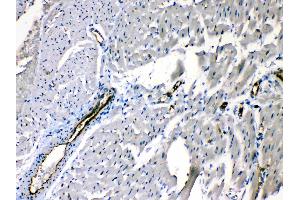 ANGPTL2 was detected in paraffin-embedded sections of rat cardiac muscle tissues using rabbit anti- ANGPTL2 Antigen Affinity purified polyclonal antibody (Catalog # ) at 1 µg/mL.