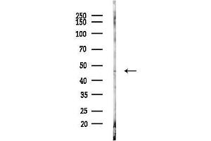 anti-IKAROS Family Zinc Finger 5 (Pegasus) (IKZF5) antibody