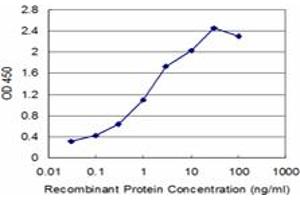 Detection limit for recombinant GST tagged SETDB1 is approximately 0. (SETDB1 抗体  (AA 2-100))