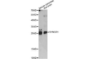 Western blot analysis of extracts of various cell lines, using SYNGR1 antibody (ABIN6290976) at 1:1000 dilution. (Synaptogyrin 1 抗体)