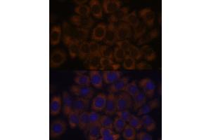Immunofluorescence (IF) image for anti-Ribosomal Protein L23A (RPL23A) (AA 1-156) antibody (ABIN1682576)