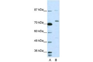 WB Suggested Anti-EXOSC10  Antibody Titration: 5. (EXOSC10 抗体  (C-Term))