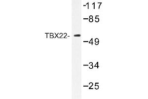 Image no. 1 for anti-T-Box 22 (TBX22) antibody (ABIN272263) (T-Box 22 抗体)