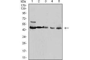 Western Blotting (WB) image for anti-Isocitrate Dehydrogenase 1 (NADP+), Soluble (IDH1) (AA 156-298) antibody (ABIN5921398)