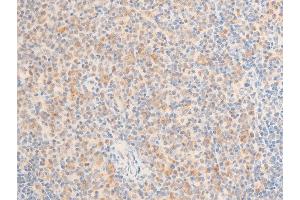 Immunohistochemistry (IHC) image for anti-Mitogen-Activated Protein Kinase Kinase Kinase 7 (MAP3K7) (pThr187) antibody (ABIN6256492)