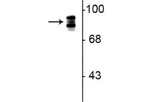 Western blot of rat lung lysate showing specific immunolabeling of the ~93 kDa periostin protein triplet. (Periostin 抗体)