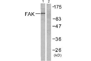 Western blot analysis of extracts from Jurkat cells untreated or treated with anti-CD3 antibody,using FAK (Ab-397) antibody (#B7081, Linand 2). (FAK 抗体  (Tyr397))
