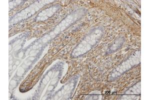 Immunoperoxidase of purified MaxPab antibody to CALD1 on formalin-fixed paraffin-embedded human small Intestine. (Caldesmon 抗体  (AA 1-538))