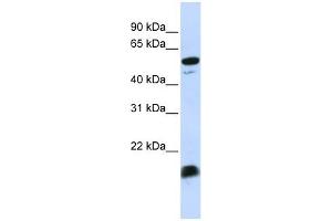 C4BPA antibody used at 1 ug/ml to detect target protein. (C4BPA 抗体  (Middle Region))