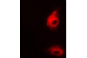 Immunofluorescent analysis of UGDH staining in HepG2 cells. (UGDH 抗体)
