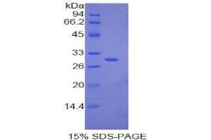 SDS-PAGE (SDS) image for Inhibitory Subunit of NF kappa B delta (IkBd) (AA 46-285) protein (His tag) (ABIN1877513)