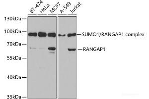 Western blot analysis of extracts of various cell lines using RANGAP1 Polyclonal Antibody at dilution of 1:1000. (RANGAP1 抗体)