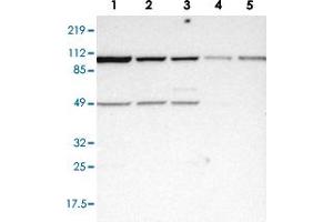Western blot analysis of Lane 1: RT-4, Lane 2: EFO-21, Lane 3: A-431, Lane 4: Liver, Lane 5: Tonsil with ASCC2 polyclonal antibody  at 1:250-1:500 dilution. (ASCC2 抗体)