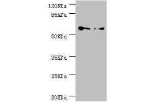 Western blot All lanes: CCT5 antibody at 1. (CCT5 抗体  (AA 1-270))