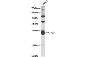 Western blot analysis of extracts of SW620 cells, using FGF19 antibody (ABIN6127925, ABIN6140595, ABIN6140596 and ABIN6222270) at 1:1000 dilution. (FGF19 抗体  (AA 25-216))