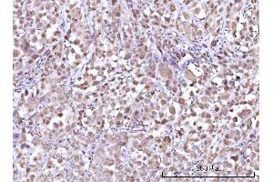 IHC analysis of RFX1 using anti-RFX1 antibody (ABIN7601842).