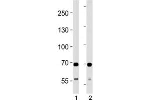 Western Blotting (WB) image for anti-Succinate Dehydrogenase Complex, Subunit A, Flavoprotein (Fp) (SDHA) (AA 577-605) antibody (ABIN3032759)