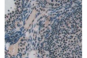 Detection of ENG in Mouse Ovary Tissue using Polyclonal Antibody to Endoglin (ENG)