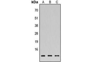 Western blot analysis of 42096 expression in HEK293T (A), NS-1 (B), H9C2 (C) whole cell lysates. (FAM215A 抗体  (C-Term))