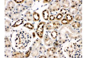 Immunohistochemistry (Paraffin-embedded Sections) (IHC (p)) image for anti-Heat Shock 70kDa Protein 8 (HSPA8) (AA 520-614) antibody (ABIN3043852)