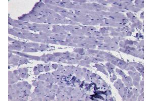 ABIN184728 Negative Control showing staining of paraffin embedded Human Bone Marrow, with no primary antibody. (KLF1 抗体  (N-Term))