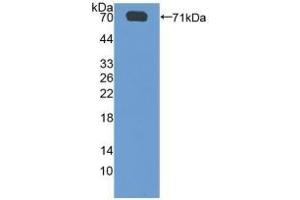 Detection of Recombinant SGSH, Human using Polyclonal Antibody to N-Sulfoglucosamine Sulfohydrolase (SGSH) (SGSH 抗体  (AA 21-389))