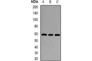Western blot analysis of Karyopherin alpha-3 expression in Jurkat (A), A549 (B), Hela (C) whole cell lysates. (KPNA3 抗体)
