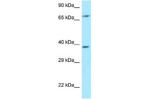 Western Blotting (WB) image for anti-Thymocyte Selection Associated (THEMIS) (C-Term) antibody (ABIN2789620) (THEMIS 抗体  (C-Term))