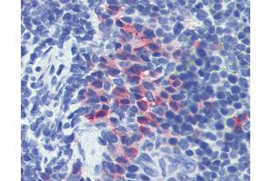 Anti-CD11b antibody IHC of mouse spleen. (CD11b 抗体)