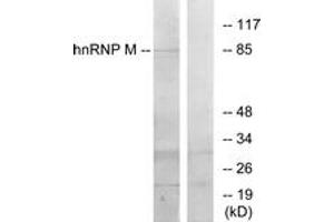 Western blot analysis of extracts from HT-29 cells, using hnRNP M Antibody.