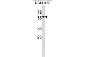 TYRP1 Antibody (Center) (ABIN1538332 and ABIN2849139) western blot analysis in NCI- cell line lysates (35 μg/lane). (Tyrosinase-Related Protein 1 抗体  (AA 341-371))