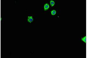 Immunofluorescent analysis of HepG2 cells using ABIN7142780 at dilution of 1:100 and Alexa Fluor 488-congugated AffiniPure Goat Anti-Rabbit IgG(H+L) (RPL26 抗体  (AA 48-143))