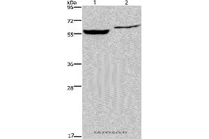 Western blot analysis of Raji and 293T cell, using IMPDH1 Polyclonal Antibody at dilution of 1:500 (IMPDH1 抗体)