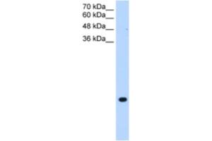 Western Blotting (WB) image for anti-Transmembrane Protein 75 (TMEM75) antibody (ABIN2463990) (TMEM75 抗体)