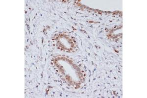Immunohistochemistry (IHC) image for anti-Histone 3 (H3) (H3K27me) antibody (ABIN6219521)