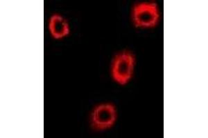 Immunofluorescent analysis of p102 staining in U2OS cells. (COPB2 抗体)