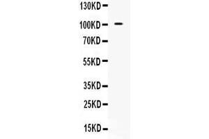 Western blot analysis of NARG1 expression in 293T whole cell lysates ( Lane 1). (NAA15 抗体  (N-Term))