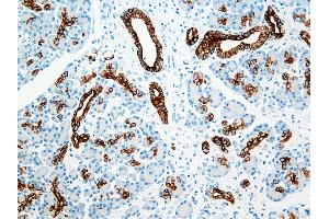 Immunohistochemistry (IHC) image for anti-Keratin 8/18/19 (KRT8/18/19) antibody (ABIN108431) (Keratin 8/18/19 抗体)