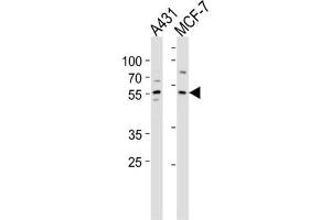 Western Blotting (WB) image for anti-Kruppel-Like Factor 4 (Gut) (KLF4) antibody (ABIN2996460) (KLF4 抗体)