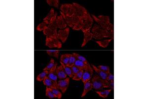 Immunofluorescence (IF) image for anti-Ribosomal Protein L8 (RPL8) (AA 1-257) antibody (ABIN6147155)